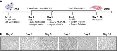 Induced pluripotent stem cell-derived smooth muscle cells to study cardiovascular calcification